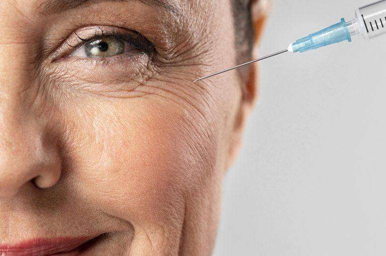 Botox gegen Falten