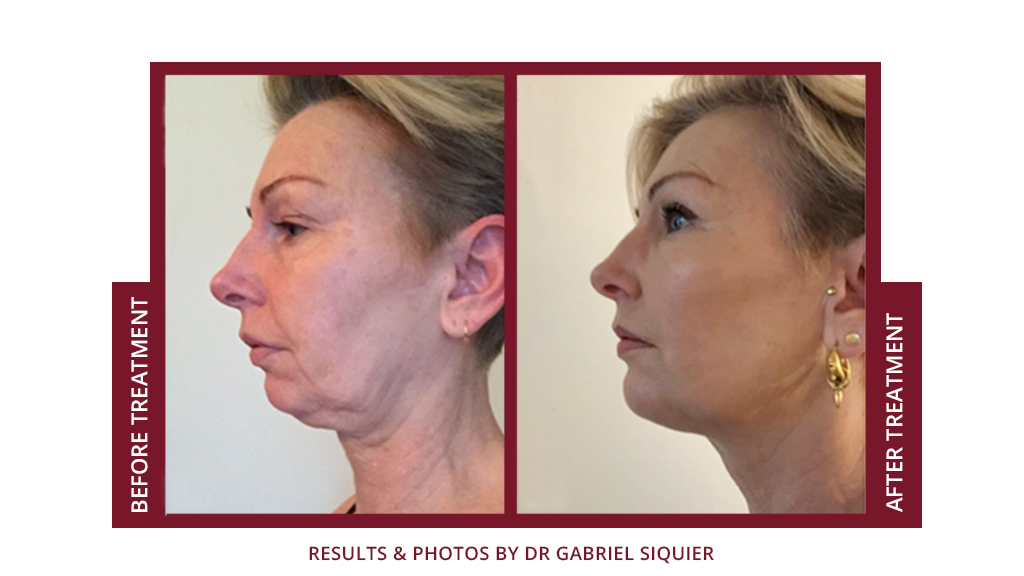 Ästhetische Medizin in Palma de Mallorca